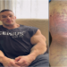 Shocker in Bodybuilding: Nick Walker Forced to Withdraw from 2023 Mr. Olympia After Hamstring Tear