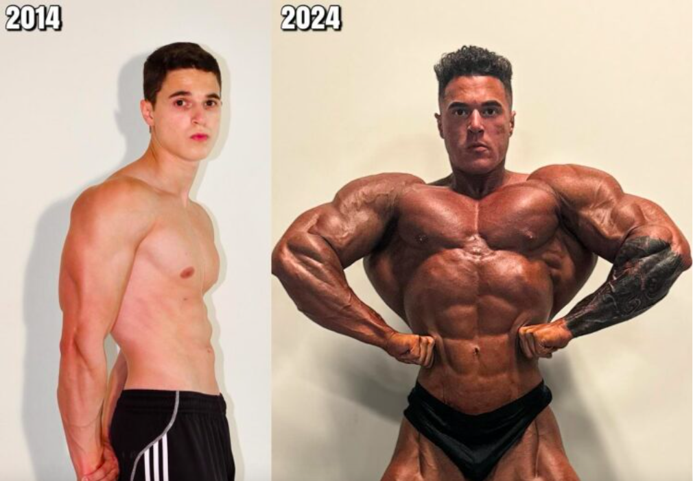 Matt Greggo Transformation early life,Matt Greggo – Complete Profile, Height, Weight, and Biography